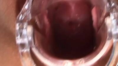 Speculum babe sucking dildo solo - drtuber